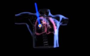 lung copy